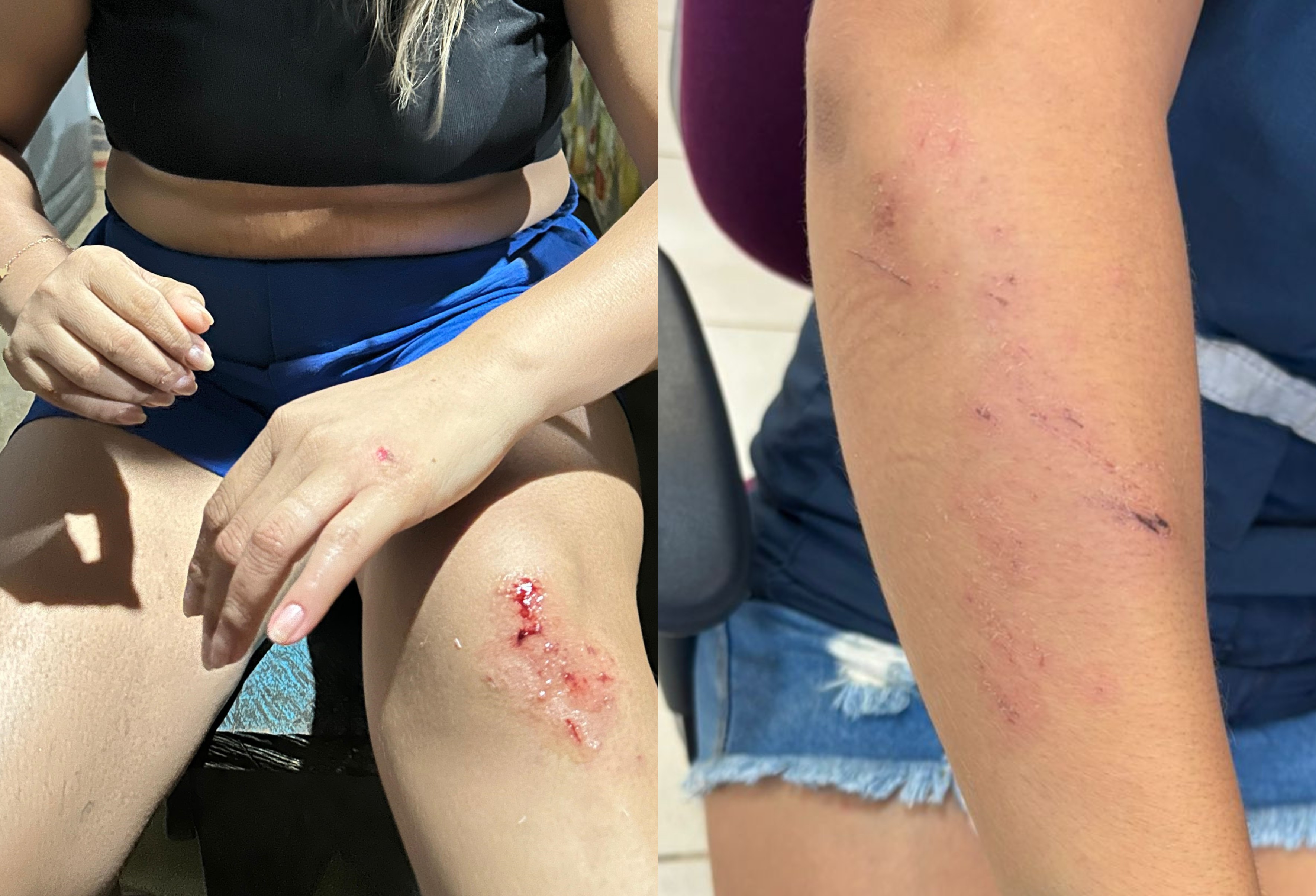 foto Not&iacute;cia Boa Vista